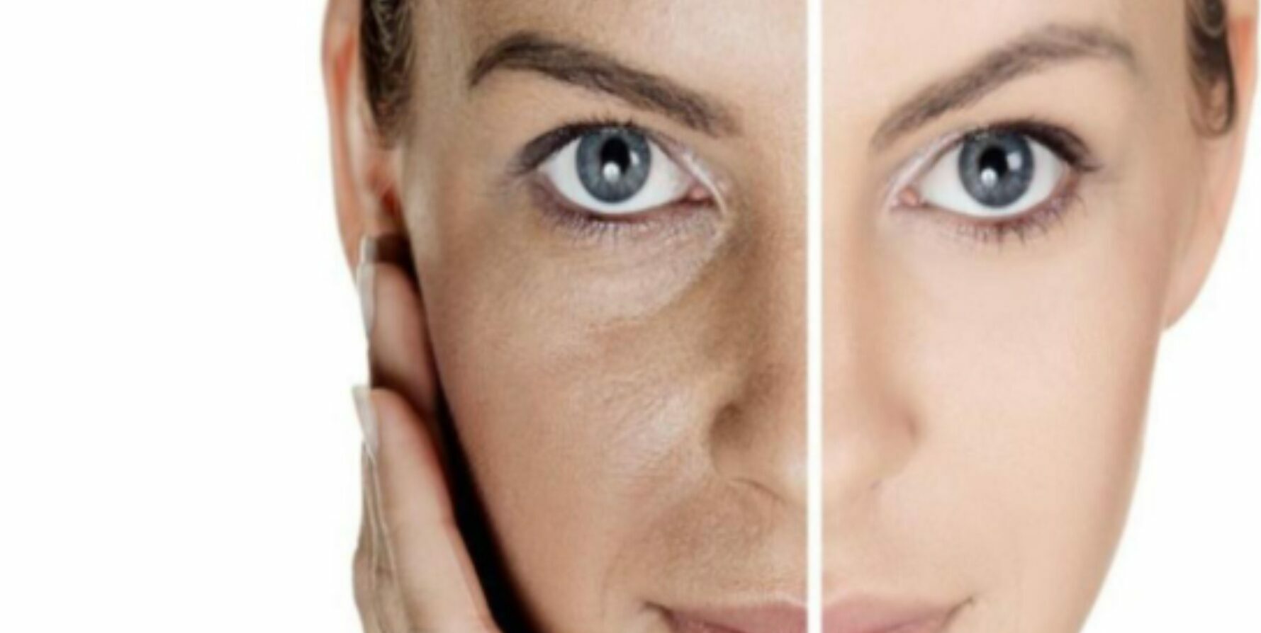 face yoga before and after treatment for dull skin